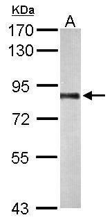 PNPase Rabbit Polyclonal Antibody
