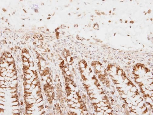 PNPase Rabbit Polyclonal Antibody