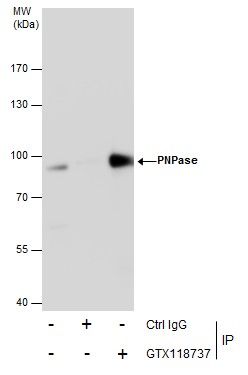 PNPase Rabbit Polyclonal Antibody