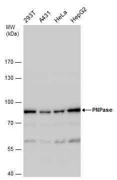 PNPase Rabbit Polyclonal Antibody