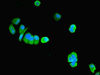 PNPLA1 Antibody