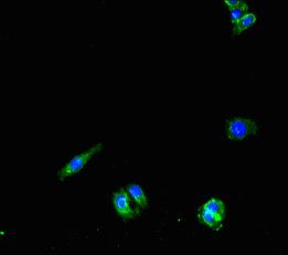 PNPLA1 Antibody