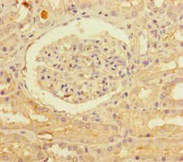 PNPLA1 Antibody