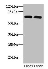 PNPLA1 Antibody