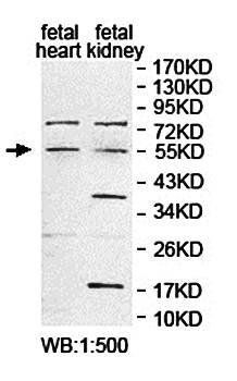 PNPLA2 Rabbit Polyclonal Antibody