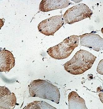 PNPLA2 Rabbit Polyclonal Antibody