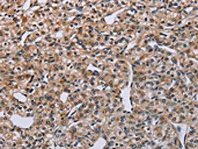 PNPT1 Antibody