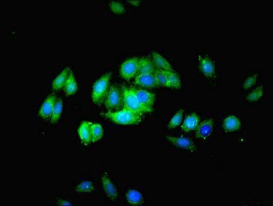 PODXL Rabbit Polyclonal Antibody