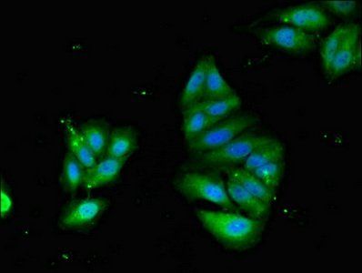 PODXL Rabbit Polyclonal Antibody