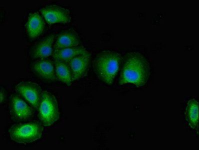PODXL Rabbit Polyclonal Antibody