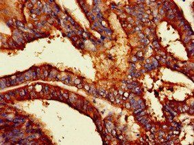 PODXL Rabbit Polyclonal Antibody