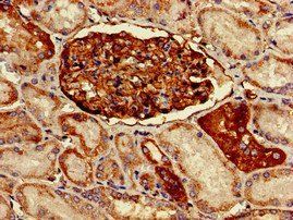PODXL Rabbit Polyclonal Antibody