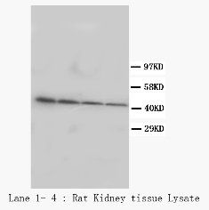 Podocin NPHS2 Rabbit Polyclonal Antibody