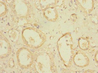 POGK Antibody