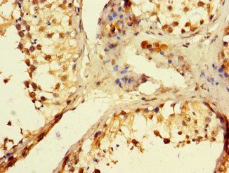 POLB Antibody
