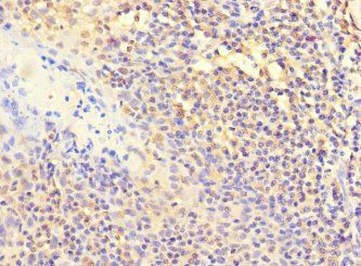 POLB Antibody