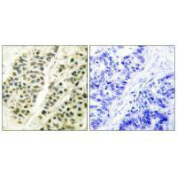 POLB Antibody