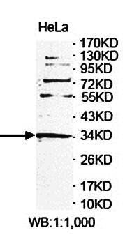 POLB Rabbit Polyclonal Antibody