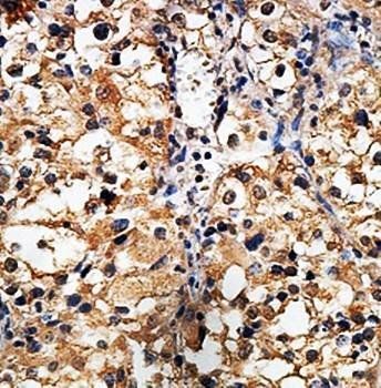 POLB Rabbit Polyclonal Antibody