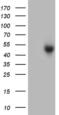 POLDIP1 Antibody