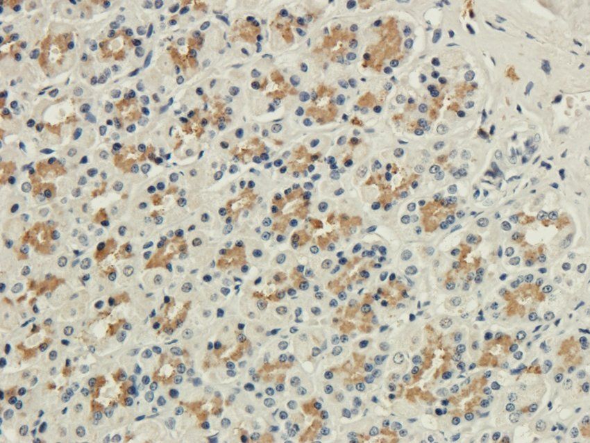 POSTN Rabbit Polyclonal Antibody