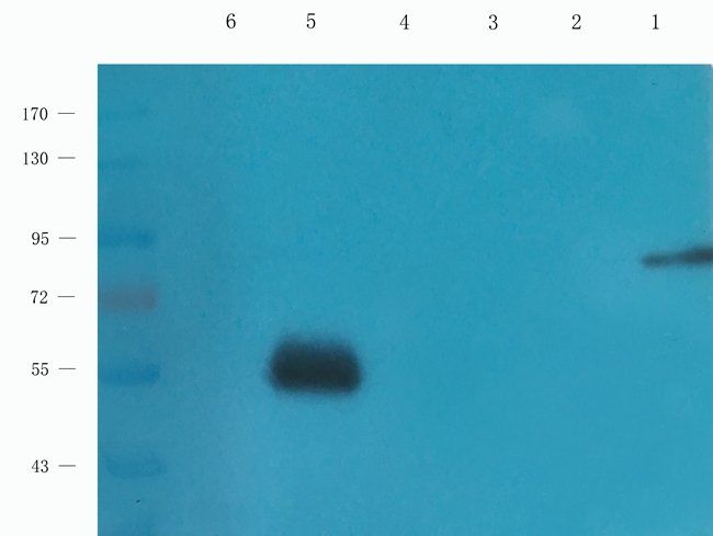 POSTN Rabbit Polyclonal Antibody