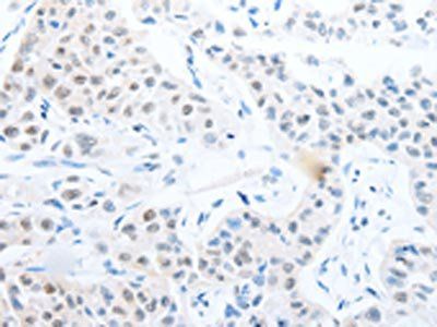 POU2F1 Antibody