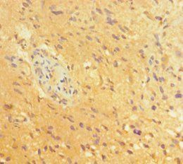 POU3F2 Antibody