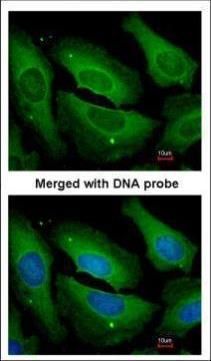 PP1C gamma Rabbit Polyclonal Antibody