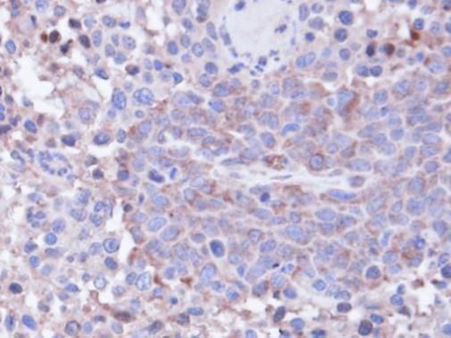 PP1C gamma Rabbit Polyclonal Antibody
