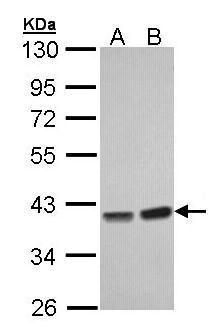 PP1C gamma Rabbit Polyclonal Antibody