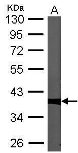 PP1C gamma Rabbit Polyclonal Antibody