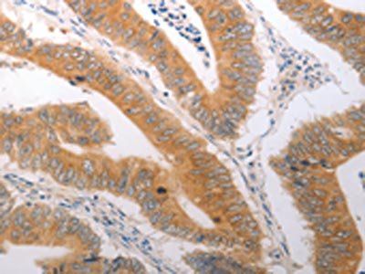 PLPP2 Antibody