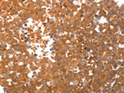 PLPP2 Antibody