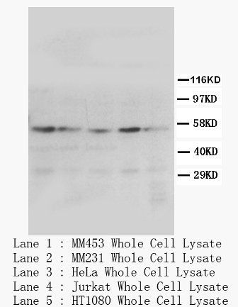 PPAR gamma/PPARG Rabbit Polyclonal Antibody
