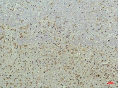 PPARD Antibody
