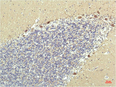 PPARD Antibody