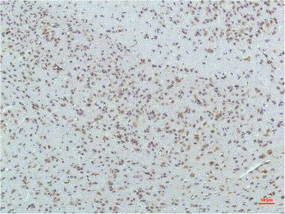 PPARD Antibody