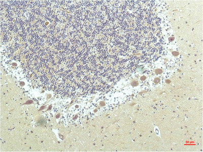 PPARD Antibody