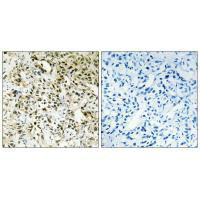 PPHLN1 Antibody