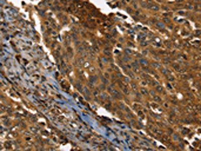 PPIA Antibody