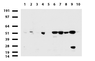 PPM1D Antibody