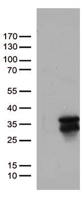 PPM1D Antibody