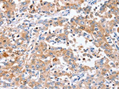 PPOX Antibody