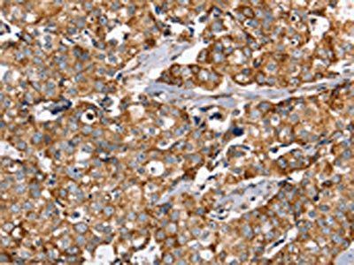 PPOX Antibody