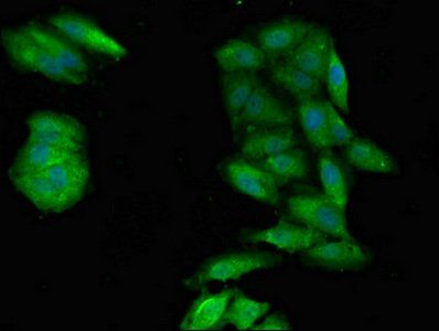 PPP1CA Antibody