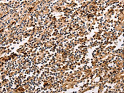 PPP1CB Antibody