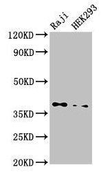 PPP1CB Antibody