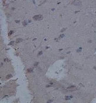 PPP1CB Rabbit Polyclonal Antibody
