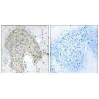 PPP1R2 Antibody